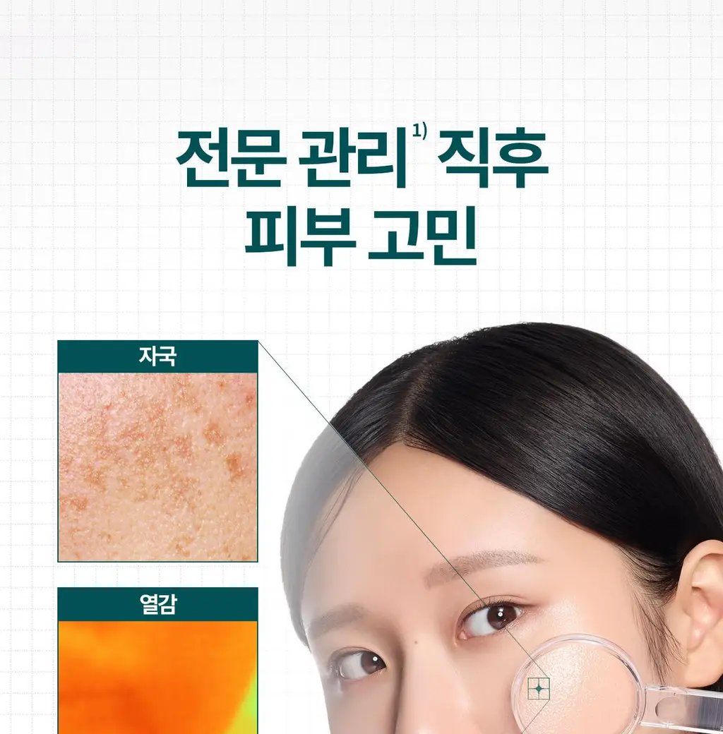 [전문 드레싱 관리_거즈 마스크]리쥬덱스 더마 리페어링 드레싱 마스크 1매 상세페이지 4